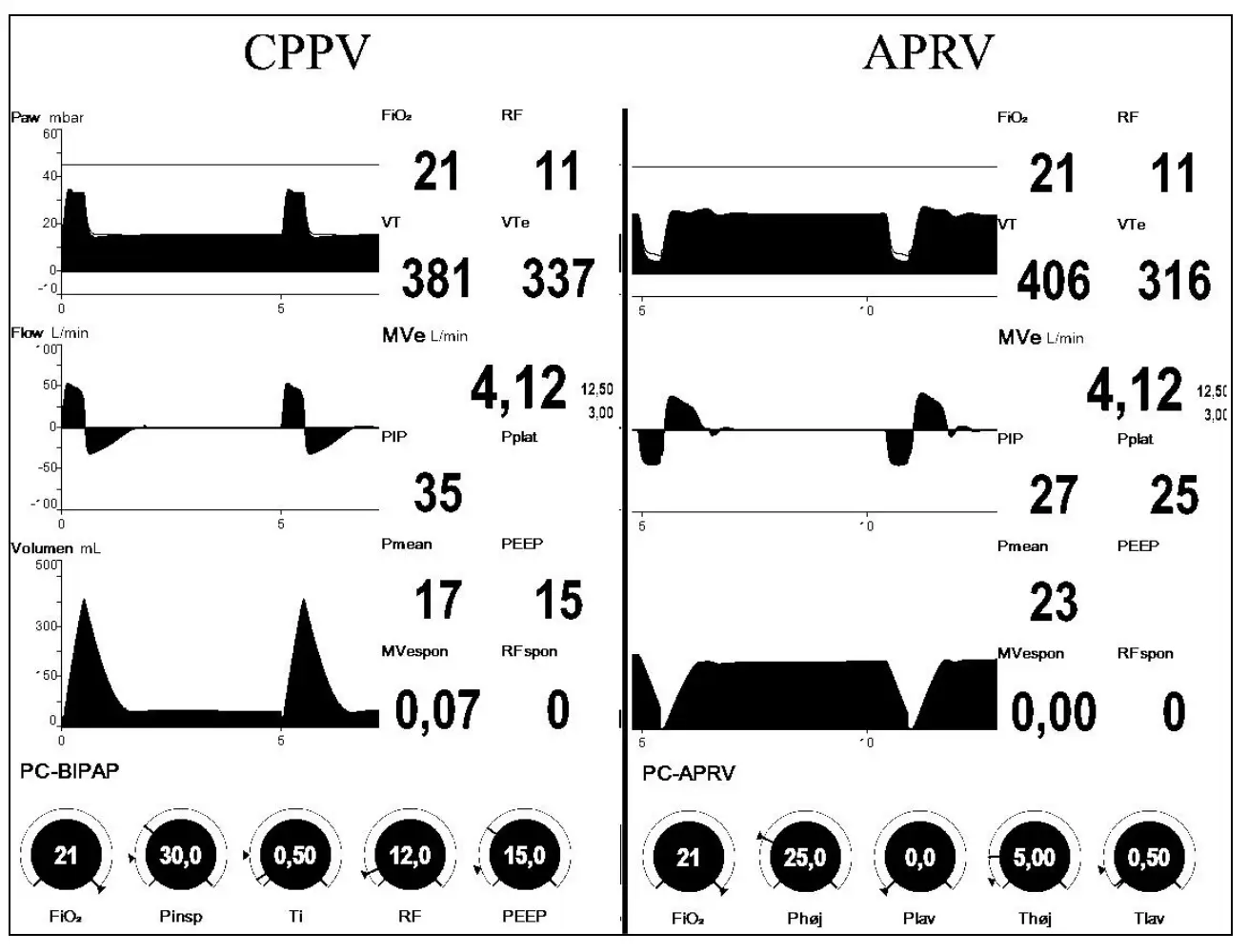 CPPV APRV